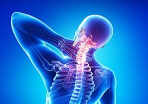 Probabilitate probagarriak osteochondrosisaren bidegurutzearekin